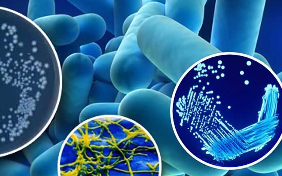 Nombres comunes de la bacteria Legionella información esencial