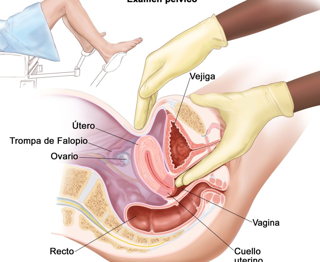 sarcoma uterino hereditario